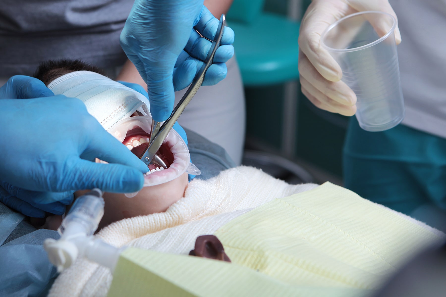 Pediatric Anesthesia dentist in Cincinnati, OH